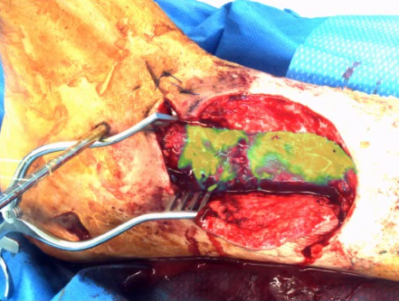 Dynamic contrast-enhanced imaging of tracer uptake in a preclinical tumor model