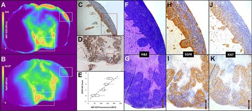 Fluorescent probe targeting biofilm in a preclinical model under imaging analysis