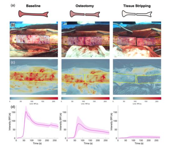 Light-activated photodynamic therapy applied to a biofilm-contaminated fracture in a preclinical model