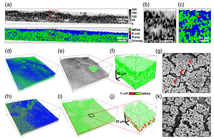 Optical coherence tomography imaging of a biofilm on an orthopaedic implant